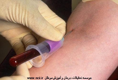 تست‌های غربالگری HIV