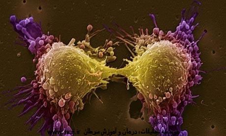 خرافه‌های مربوط به سرطان پروستات