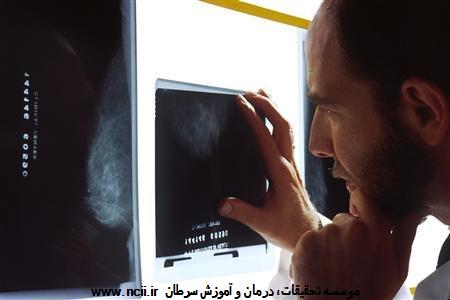 سرطان پستان و ماموگرام