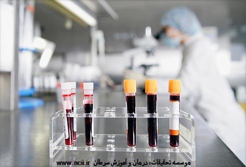  تست‌های آزمایشگاهی مربوط به متاستاز استخوانی