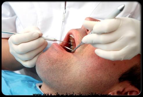 تغییرات در دهان (ضایعات مزمن دهانی که التیام نمی‌یابند)
