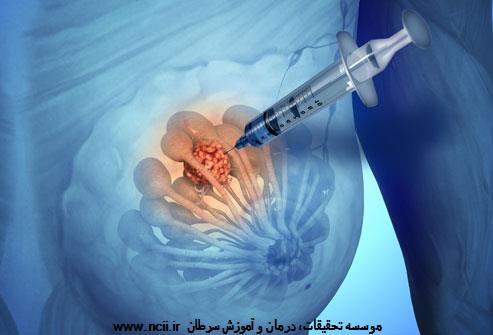 نمونه برداری از پستان
