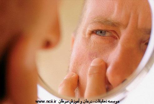غربالگری سرطان پوست